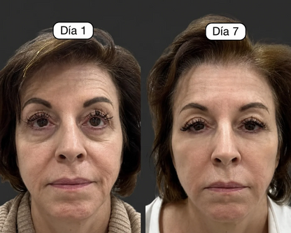 Cepillo facial Drenaje linfatico Masajea